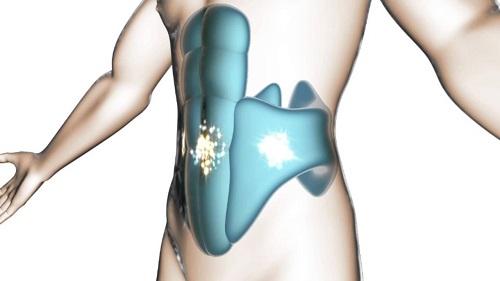 Ceinture abdos slendertone Abs : Notre avis sur son Ceinture abdos slendertone Abs : Notre avis sur son